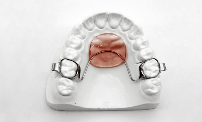 nance-space-maintainer-tiny-teeth-of-tally